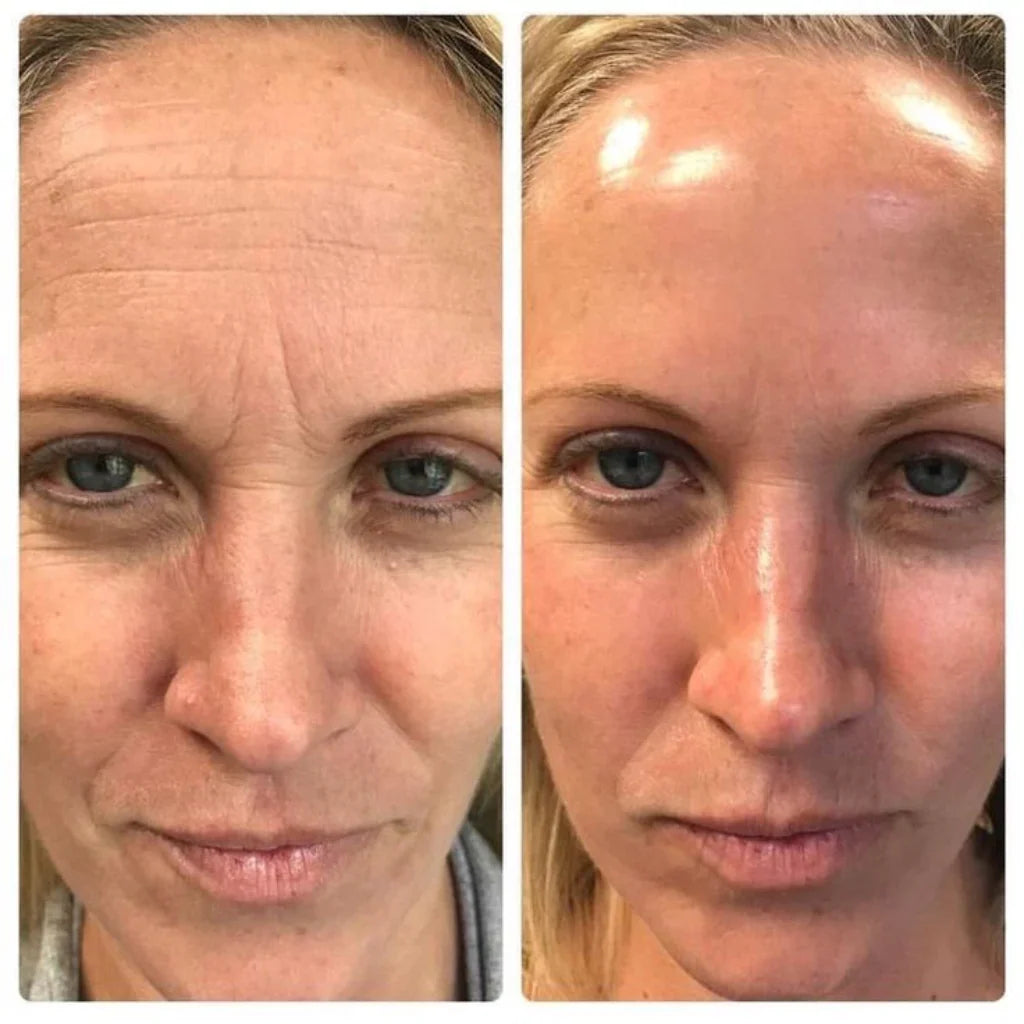 Renovea Retinal Shot 50ml | Suaviza Arrugas y Reafirma La Piel