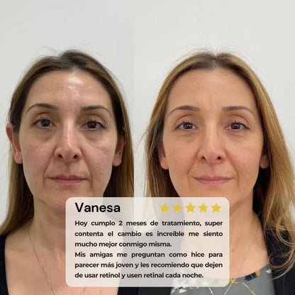 Renovea Retinal Shot 50ml | Suaviza Arrugas y Reafirma La Piel