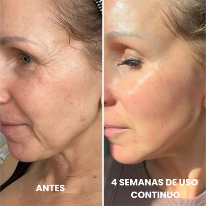 Renovea Retinal Shot 50ml | Suaviza Arrugas y Reafirma La Piel